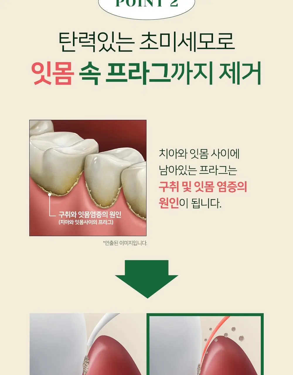[유시몰X헌터] 트레블 파우치+유시몰 구취완벽케어 기획(오리지널 치약106g+구강스프레이+칫솔+혀클리너) 상세페이지 54